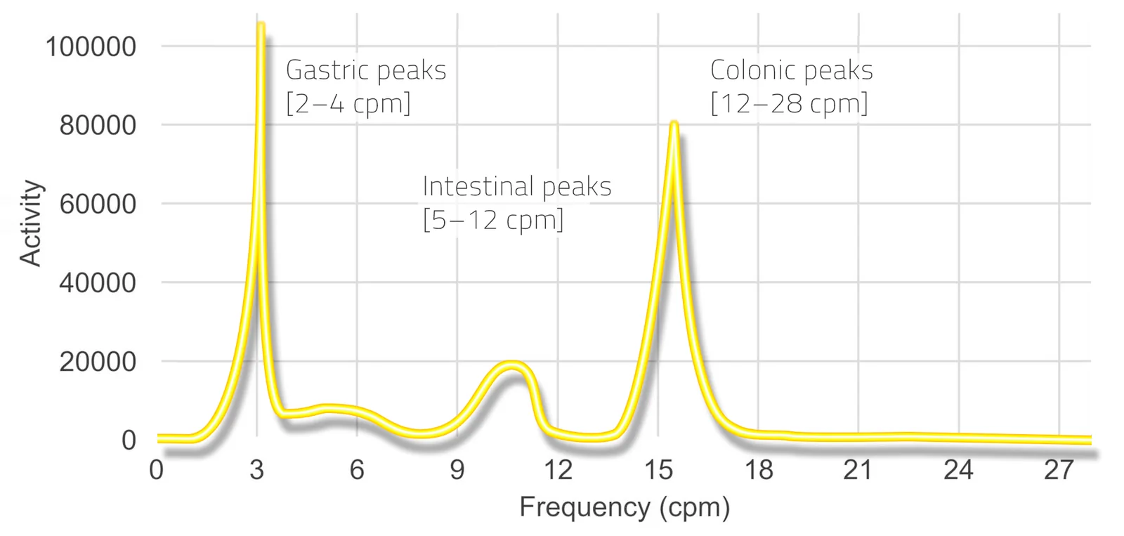 A representative GutPrint: a frequency spectrum of gastrointestinal myoelectric activity with distinct stomach, small intestine and colon peaks.