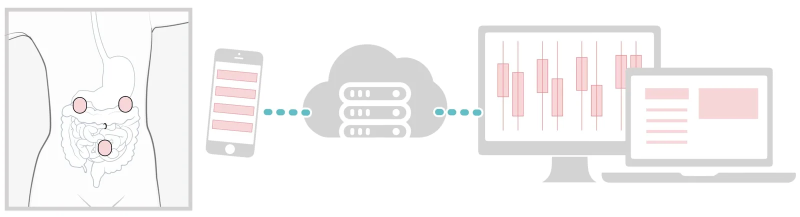 Three GutTracker patches beside a rendering of the signal path from patch to phone to cloud analysis to physician report.